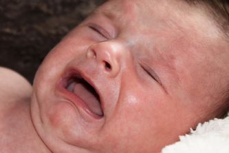 Excessive crying is commonly seen in CMPA
